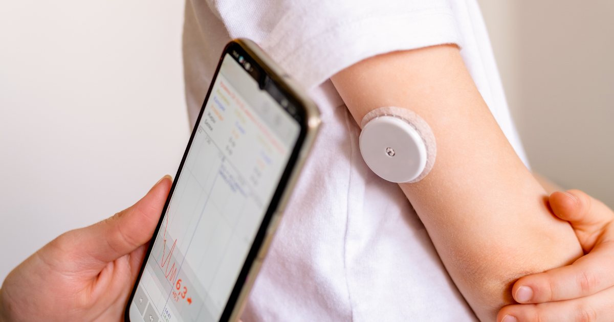 Close-up of smartphone scanning a small CGM patch on upper arm, demonstrating discreet continuous glucose monitoring at home.